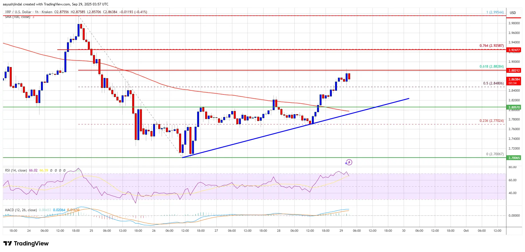 XRP Price Attempts Recovery – Can Market Push Higher Despite Strong Barriers？